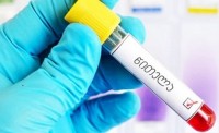 2019 წელს საქართველოში წითელას გამო ერთი ადამიანი გარდაიცვალა